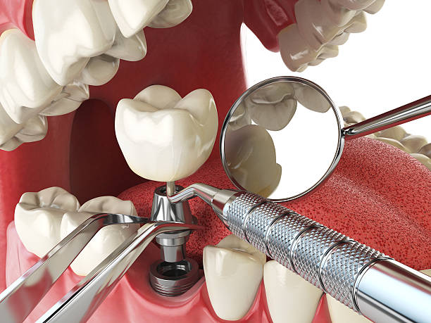 Best Emergency Dental Services for Seniors in El Paso, TX